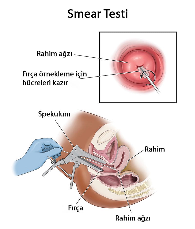 smear testi