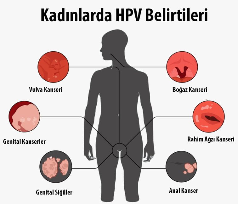 kadınlarda hpv belirtileri