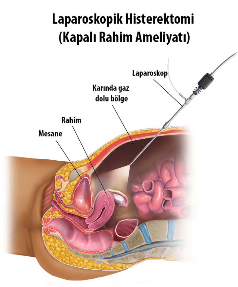 Vajinal Flora Nedir? Genital Hijyen Nasıl Sağlanır? Vajinal Flora Nedir? Genital Hijyen Nasıl Sağlanır?